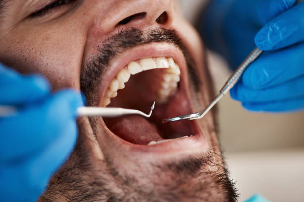 Best Urgent Dental Care for Toothaches in Idabel, OK